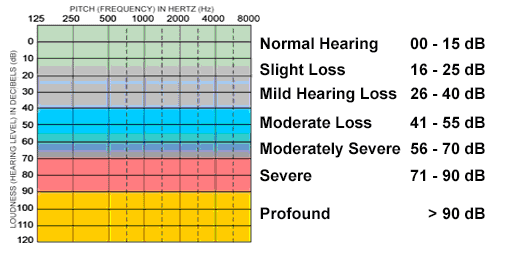 Hearing Loss Severity Chart